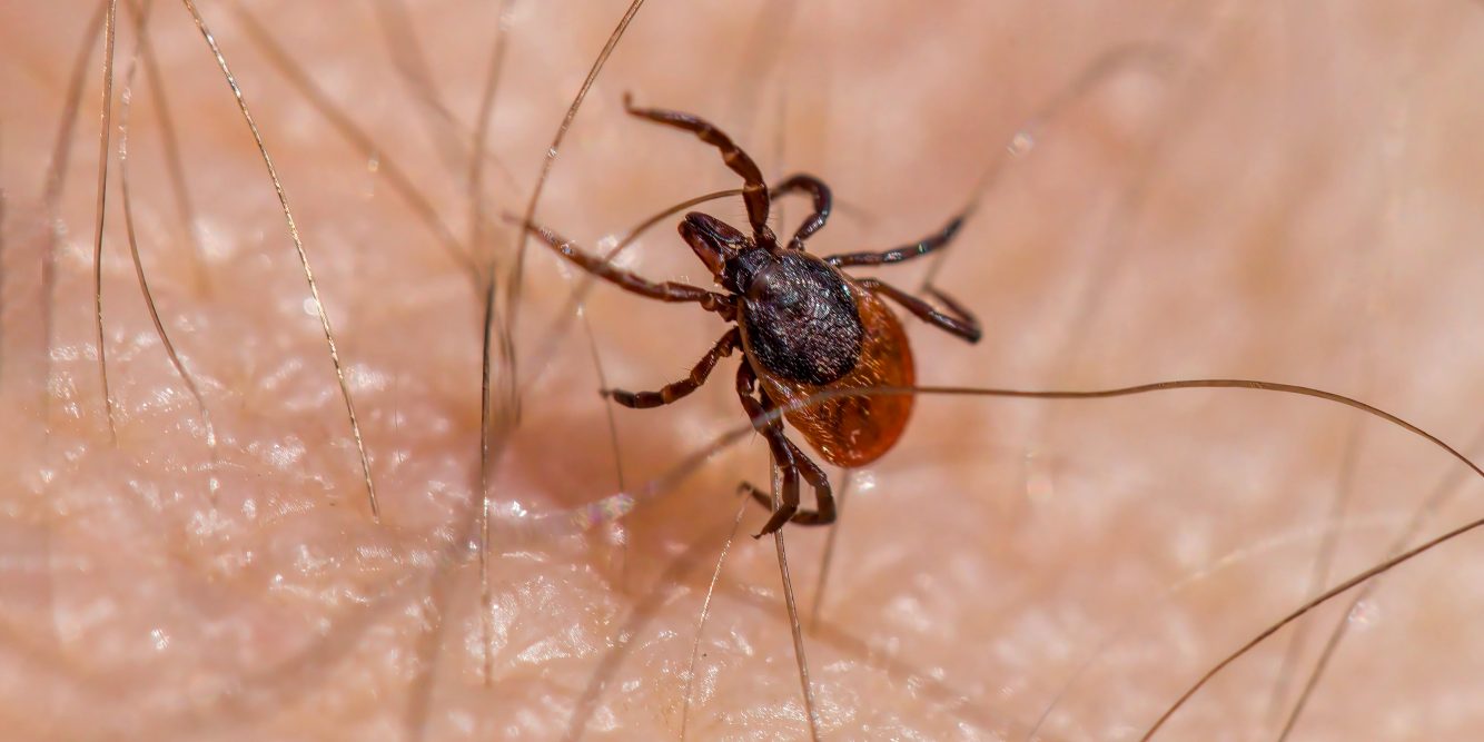 Concord Man Hospitalized From Tick Bite